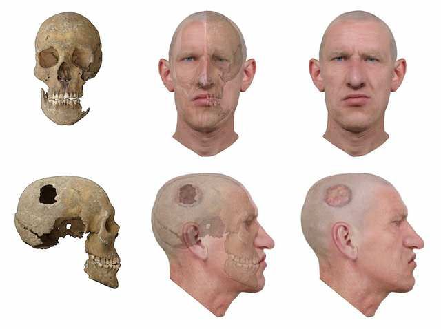 How Forensic Scientists Reconstruct Faces from Skulls – Bone Clues Explained